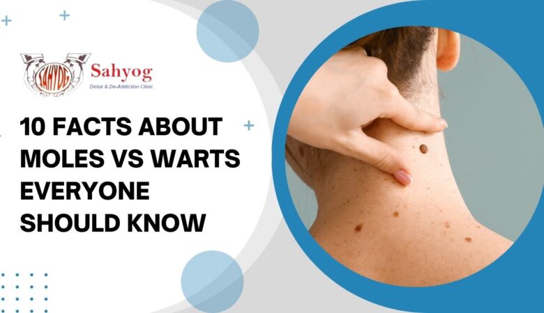 10 Facts About Moles Vs Warts Everyone Should Know