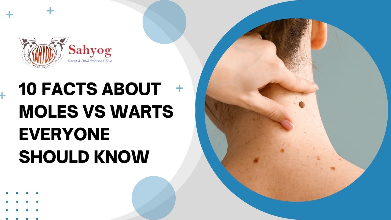 10 Facts About Moles Vs Warts Everyone Should Know